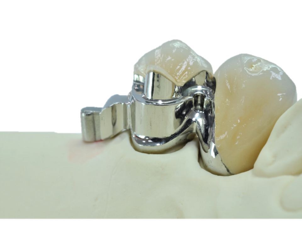 Atečmeni kot estetsko-funkcionalne rešitve v vsakdanji praksi - Kombinirana dela - osnovni