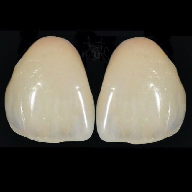 Keramika - Master tečaj | Dental sketches 