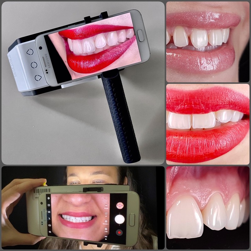 Tečaj dentalne fotografije z mobilnim telefonom ter SmileLite MDP