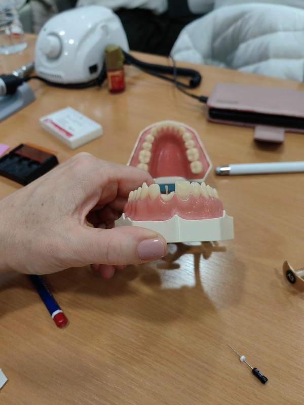 Sodobni pristopi k protetični oskrbi endodontsko zdravljenega zoba