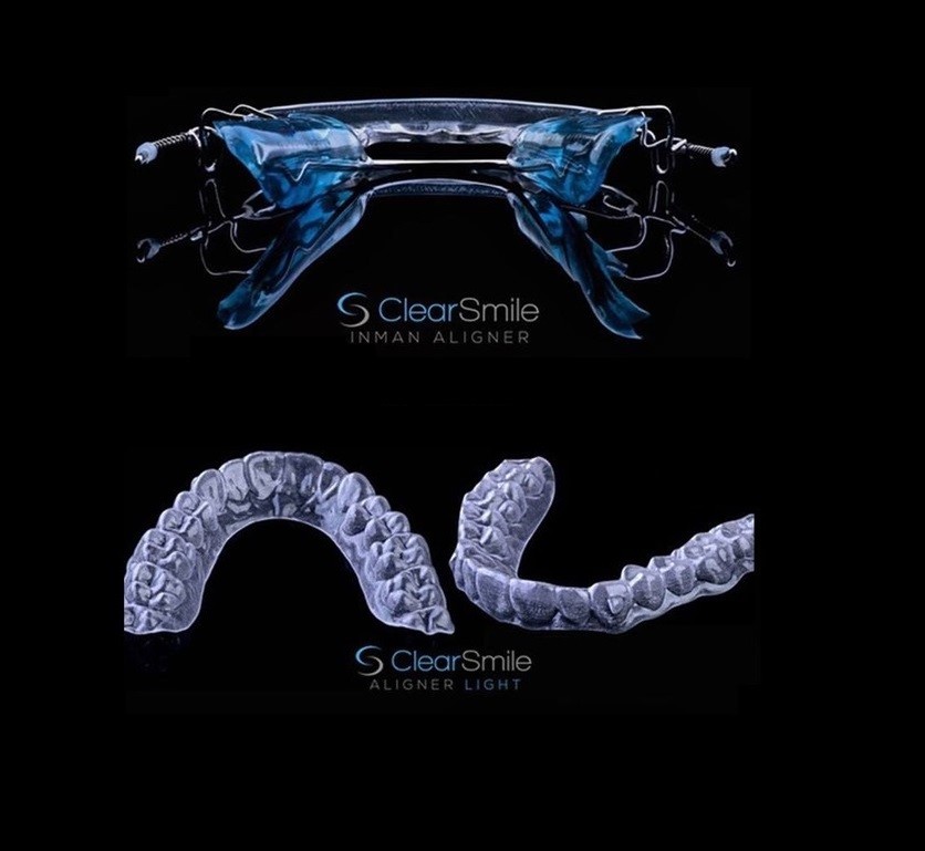 IAS Academy - ClearSmile Aligner Light in Inman Aligner